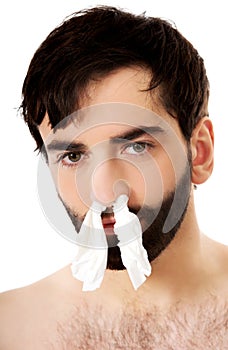 Sick man with tissues in nose.