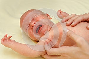 Sick newborn child with alergy rash is weeping