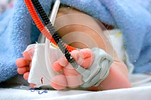 Sick newborn crisis baby foot Insert a Oxygen strap and saline to measure oxygen in the blood