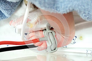 Sick newborn crisis baby foot Insert a Oxygen strap and saline to measure oxygen in the blood