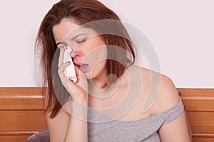 Sick Woman Caught Cold. Sneezing into Tissue. Headache