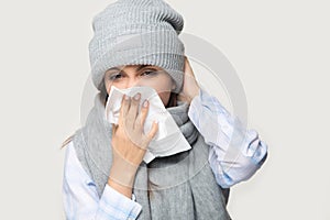 Sick young woman blow nose suffering from flu