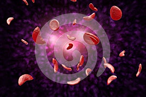 Sickle Cell Anemia 3D Illustration