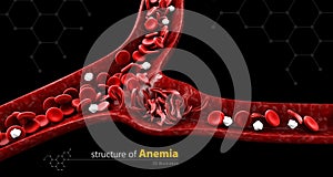 Sickle cell anemia, illustration showing blood vessel with normal and deformed crescent isolated black