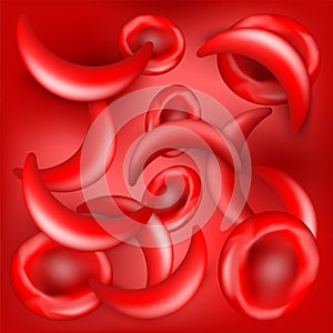 Sickle cell disease. SCD. red background. Anemia or anaemia photo