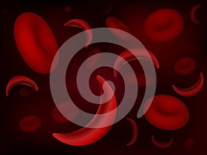 Sickle-cell and normal red blood cells photo