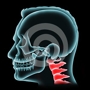 Side of human head or skullâ€‹ isolatedâ€‹ onâ€‹ blackâ€‹ graphic background.Green x-Ray film forâ€‹ checkâ€‹ orâ€‹ analysis