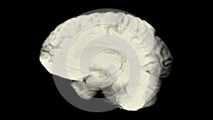 Side view brain with alpha matte. Neurological diseases