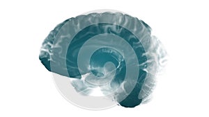 Side View Brain On White Background. Neurological Diseases, Tumors And Brain Surgery