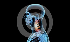 Tridimensionale medico illustrazioni da collo scheletro cervicale Dolore 