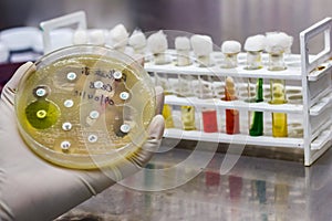 Side view of Culture plate of bacterial growth showing antibiotic sensitivity in their colony pattern placed geld in gloved hand photo