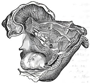 Sigmoid sulcus topography - temporal bon