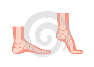 Silhouette human foot with bones, orthopedic leg, healthy feet. Full foot and tiptoe. Foot normal, flat foot. Supination
