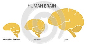 Silhouette image of human brain adult, newborn child with a normal brain and severe microcephaly. Virus of Zika. Vector. Flat