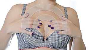 Silicone breast implants and bra