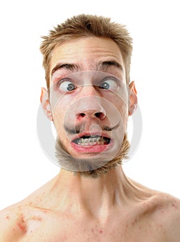 Silly man with crossed eyes