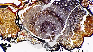 Silvering pattern of human nerves trunk in transversal section under microscope 100x