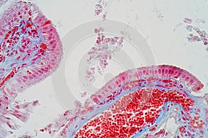 simple columnar epithelium is a columnar epithelium that is uni-layered. In humans,