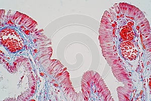 simple columnar epithelium is a columnar epithelium that is uni-layered. In humans,