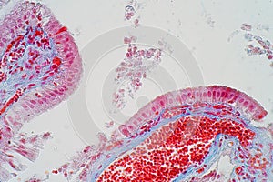 simple columnar epithelium is a columnar epithelium that is uni-layered. In humans, photo