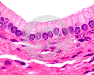 Simple columnar epithelium photo