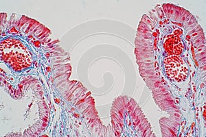 simple columnar epithelium is a columnar epithelium that is uni-layered. In humans, photo