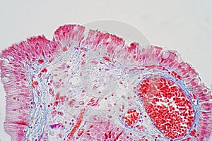 simple columnar epithelium is a columnar epithelium that is uni-layered. In humans photo