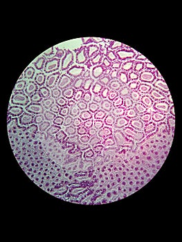 Simple epithelial cell of kidney