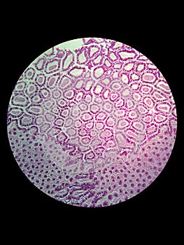 Simple epithelial cell of kidney photo