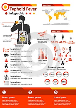 Infectious Disease Infographics - Typhoid Fever photo