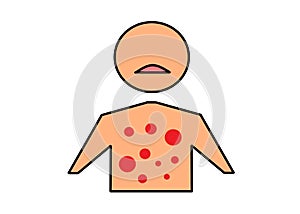 A simple shape of a human body upper torso with red dots indicating rashes and sensitive skin