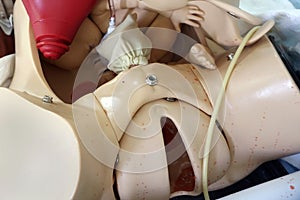 Simulation mannequin for childbirth during training for obstetricians.
