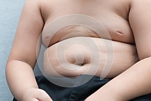 The size of stomach of children with overweight.