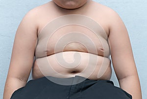 The size of stomach of children with overweight.