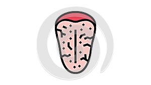 sjogrens syndrome color icon animation