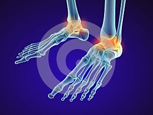 Skeletal foot - injuryd talus bone. Xray view. Medically accurate illustration photo