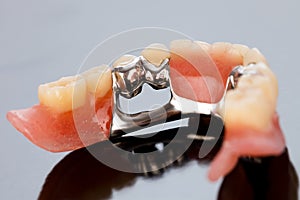 Skeletal prosthesis - fixing elements