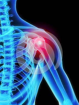 Skeletal shoulder with pain