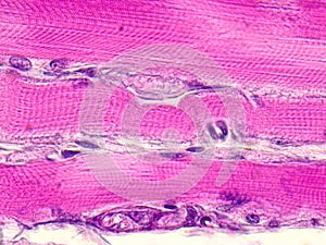 Skeletal striated muscle tissue under the microscope