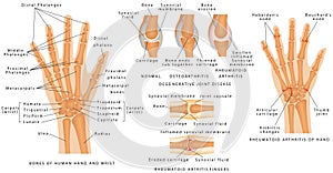 Skeletal System Phalanges