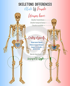 Skeleton differences image