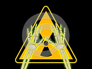 Skeleton hands with symbol of radiation warning