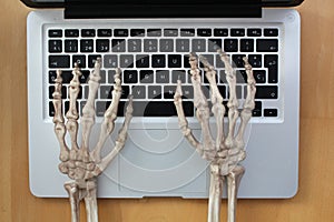 Skeleton hands typing on laptop. photo
