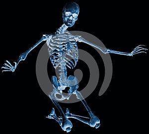 Skeleton kneel x ray