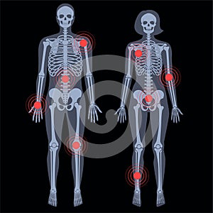 Skeleton x ray