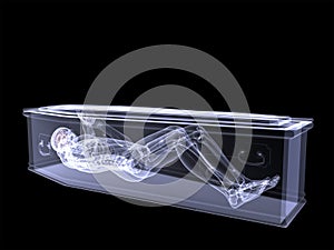 Skeleton X-Ray - Trapped in a Coffin