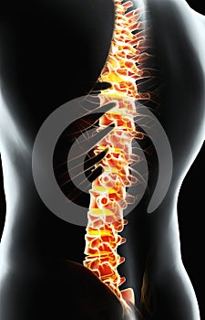 Skeleton system - X-ray human spine.