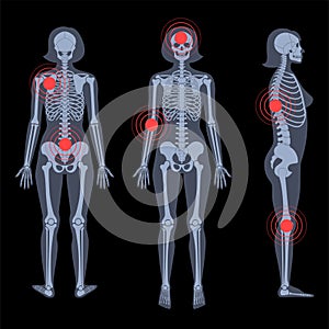 Skeleton x ray