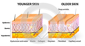 Skin aging