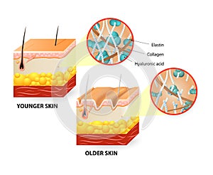 Skin aging